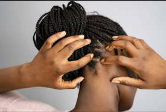 How to Enjoy Your Braids Without the Itch: 4 Simple Tips You Need to Try.